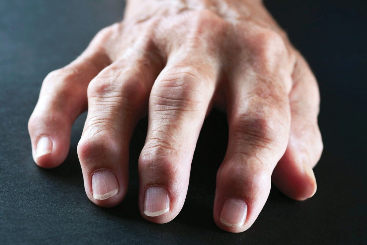 Arthritis treatment in ghaziabad