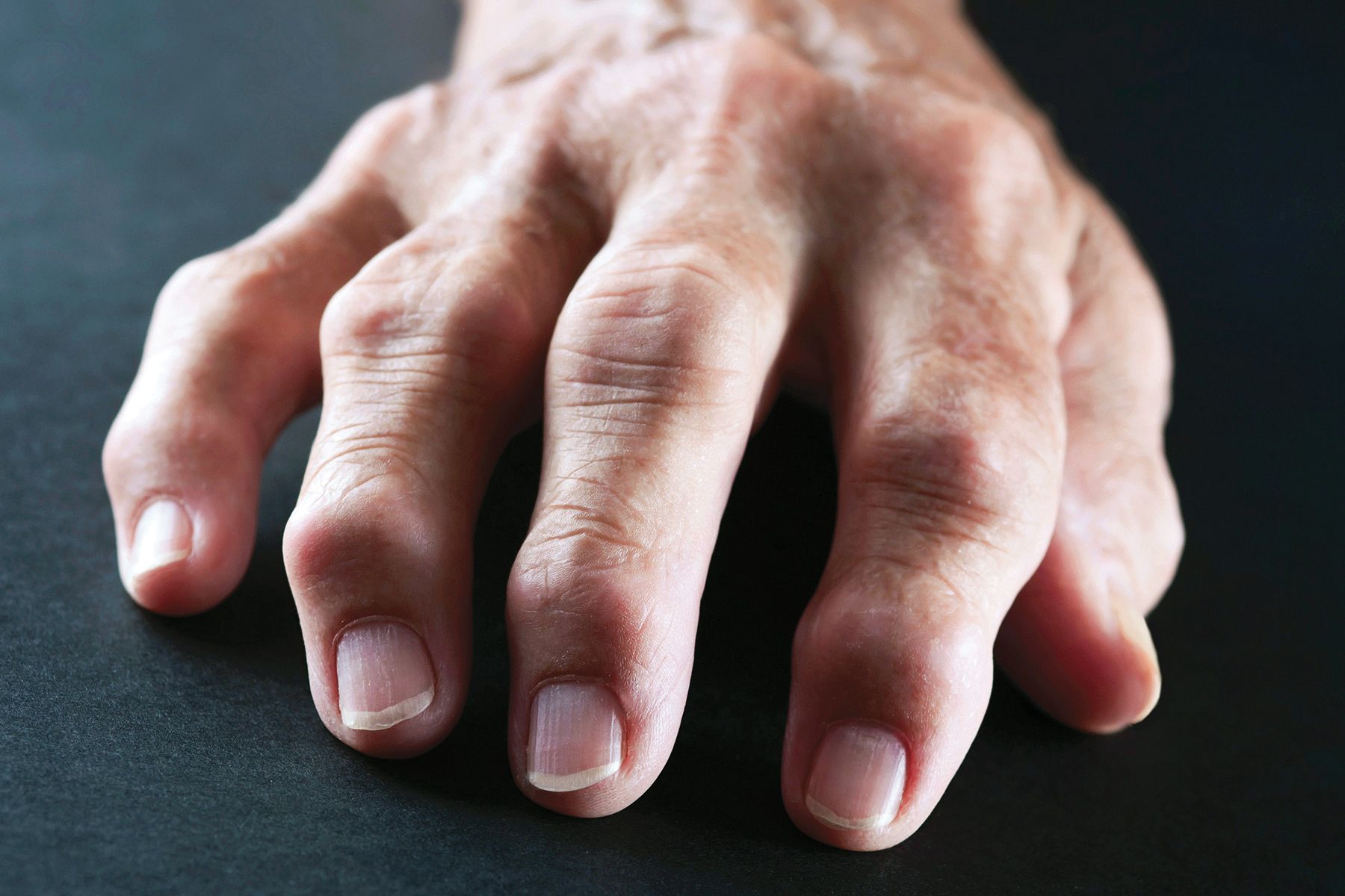 Arthritis treatment in ghaziabad